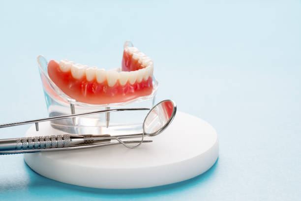 Dental Inlays and Onlays in Dublin, VA
